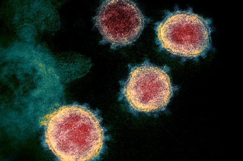 Trata-se de um viricida, uma substância que destrói o vírus ao bloquear sua entrada nas células humanas. Com isso, ele não pode se replicar. Foto: NIAID/Divulgação